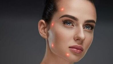 Que é o rexuvenecemento cutáneo fraccionado