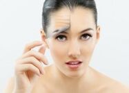Nena despois do rexuvenecemento facial con láser fraccionado