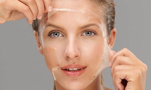 O peeling profundo mellora os procesos de rexeneración da pel, rexuvenecéndoa
